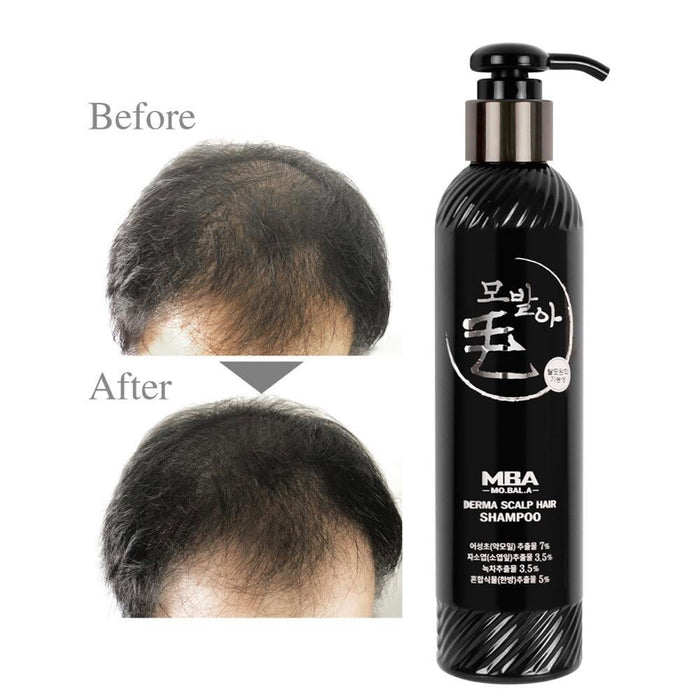 MBA MoBalA Derma Scalp Hair Shampoo 230ml/ bottle